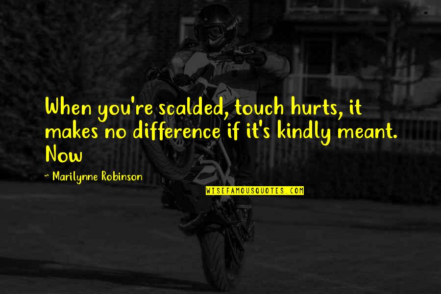 Audaciously Rude Quotes By Marilynne Robinson: When you're scalded, touch hurts, it makes no