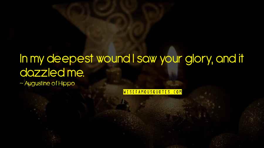 Auto Warranty Quotes By Augustine Of Hippo: In my deepest wound I saw your glory, Auto Warranty Quotes By Augustine Of Hippo: In my deepest wound I saw your glory,