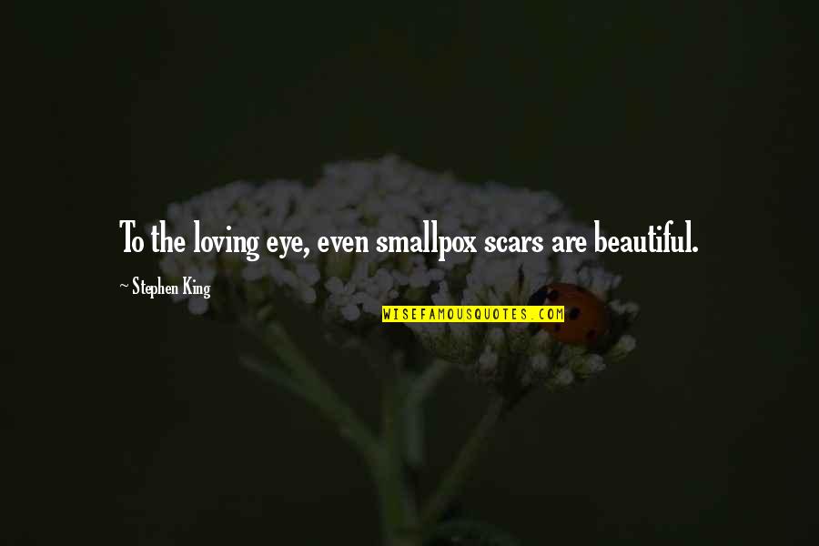 Beautiful Eye Quotes By Stephen King: To the loving eye, even smallpox scars are