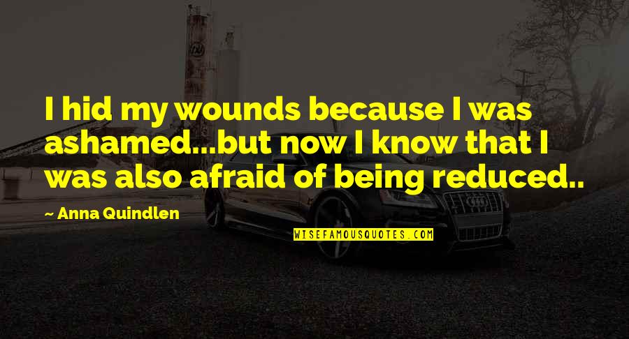 Being Ashamed Quotes By Anna Quindlen: I hid my wounds because I was ashamed...but
