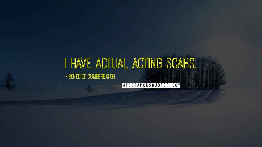 Benedict Cumberbatch quotes: I have actual acting scars.