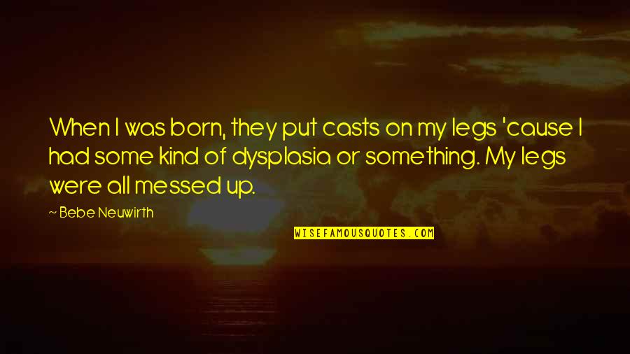 Bocephus Quotes By Bebe Neuwirth: When I was born, they put casts on Bocephus Quotes By Bebe Neuwirth: When I was born, they put casts on
