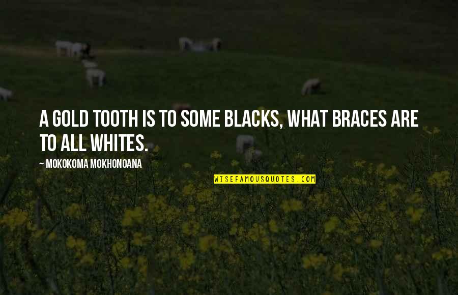 Braces On Teeth Quotes By Mokokoma Mokhonoana: A gold tooth is to some blacks, what