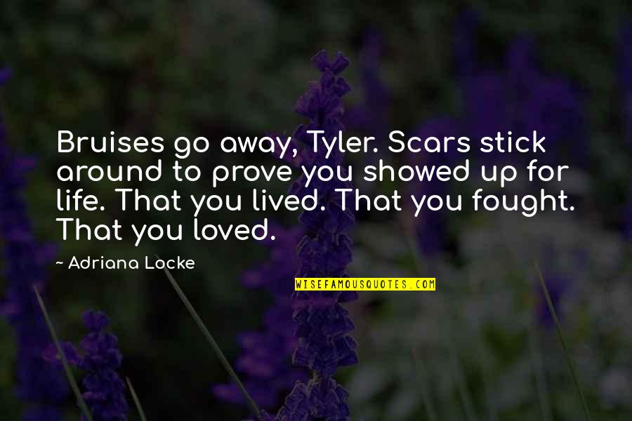 Bruises'n Quotes By Adriana Locke: Bruises go away, Tyler. Scars stick around to