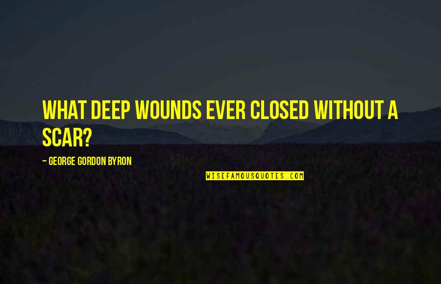 Byron Quotes By George Gordon Byron: What deep wounds ever closed without a scar?