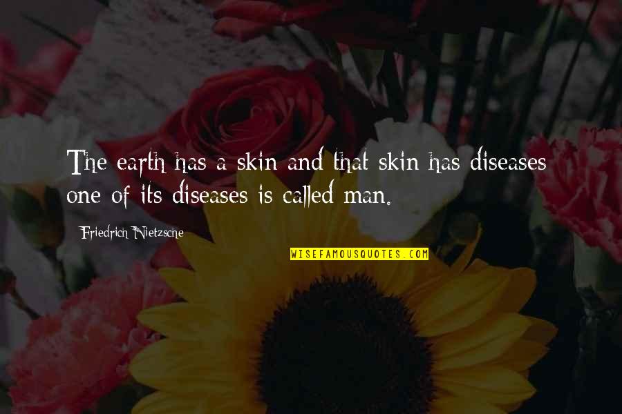 Calabrese Slang Quotes By Friedrich Nietzsche: The earth has a skin and that skin