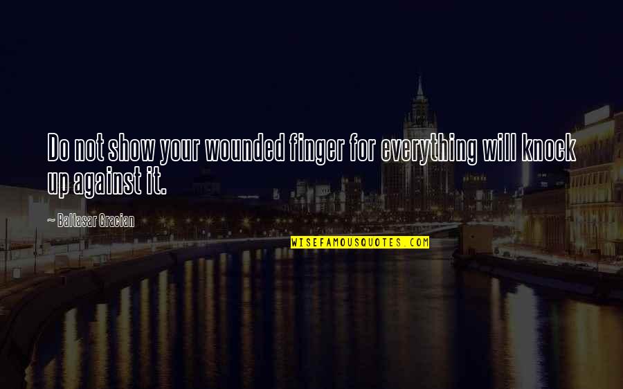 Capelle Bros Quotes By Baltasar Gracian: Do not show your wounded finger for everything Capelle Bros Quotes By Baltasar Gracian: Do not show your wounded finger for everything
