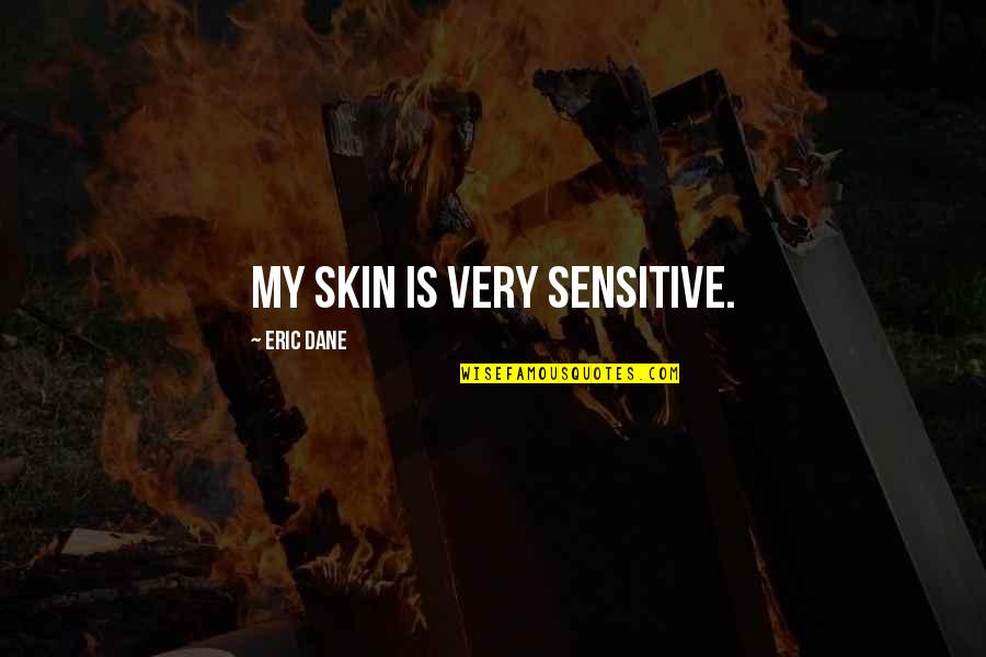 Chesky Records Quotes By Eric Dane: My skin is very sensitive.