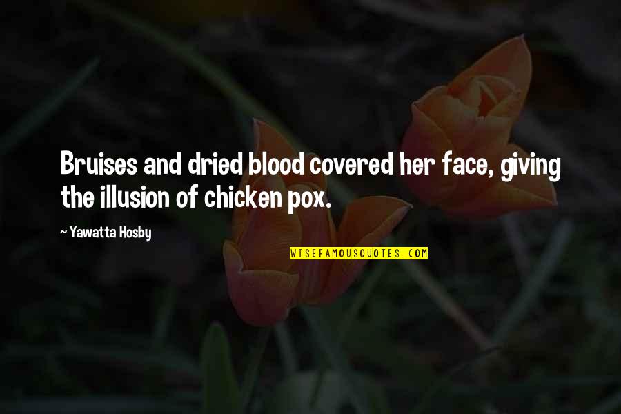 Chicken Pox Quotes By Yawatta Hosby: Bruises and dried blood covered her face, giving
