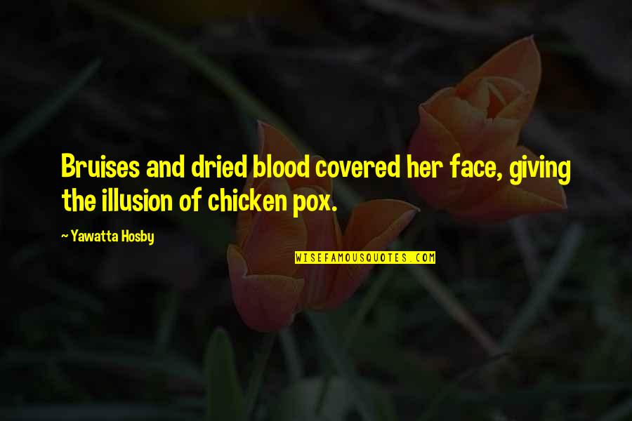 Covered Quotes By Yawatta Hosby: Bruises and dried blood covered her face, giving