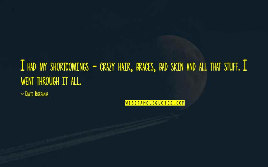 Crazy Stuff Quotes By David Boreanaz: I had my shortcomings - crazy hair, braces,