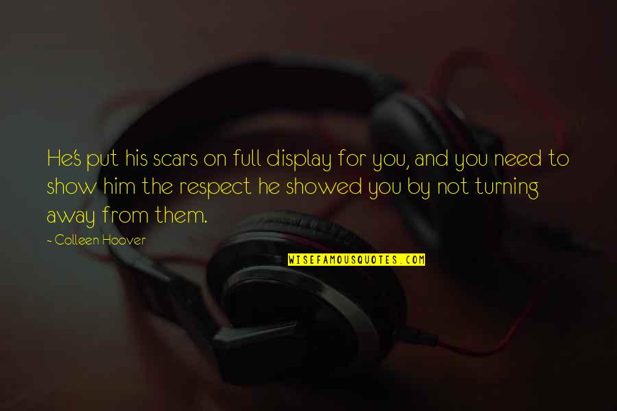 Cute Short Art Quotes By Colleen Hoover: He's put his scars on full display for