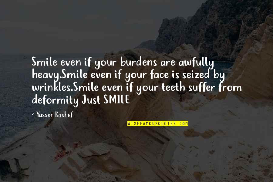 Dabat Quotes By Yasser Kashef: Smile even if your burdens are awfully heavy.Smile