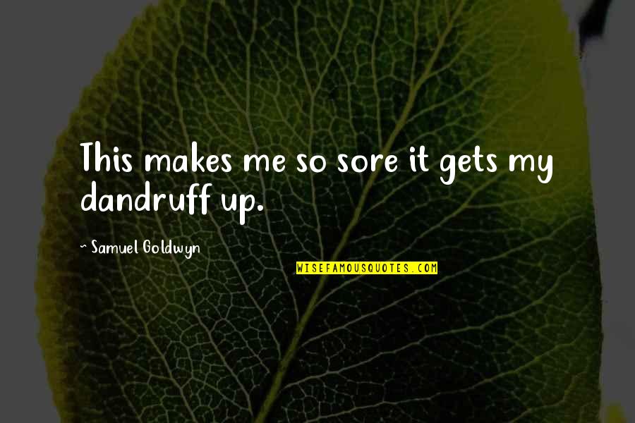 Dandruff's Quotes By Samuel Goldwyn: This makes me so sore it gets my Dandruff's Quotes By Samuel Goldwyn: This makes me so sore it gets my