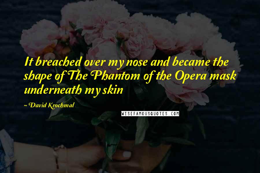 David Krochmal quotes: It breached over my nose and became the shape of The Phantom of the Opera mask underneath my skin