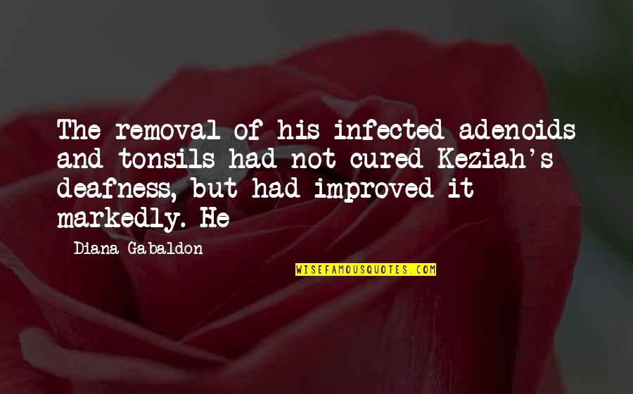 Deafness Quotes By Diana Gabaldon: The removal of his infected adenoids and tonsils