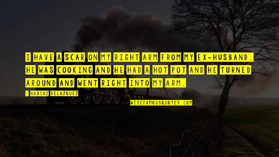 Desmond Thomas Doss Quotes By Nadine Velazquez: I have a scar on my right arm Desmond Thomas Doss Quotes By Nadine Velazquez: I have a scar on my right arm