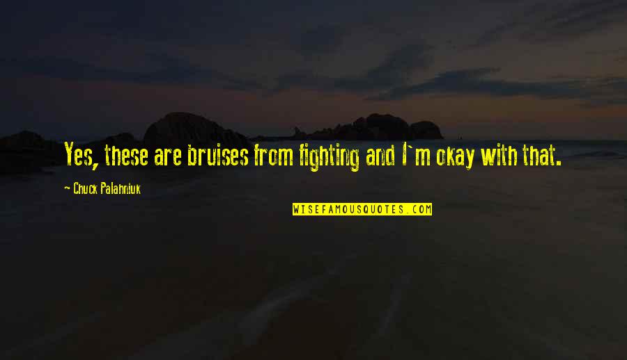 Diagnostics Of America Quotes By Chuck Palahniuk: Yes, these are bruises from fighting and I'm Diagnostics Of America Quotes By Chuck Palahniuk: Yes, these are bruises from fighting and I'm