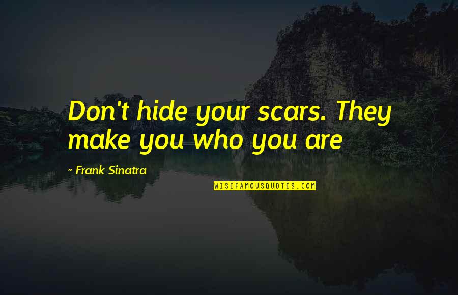Don't Hide Quotes By Frank Sinatra: Don't hide your scars. They make you who