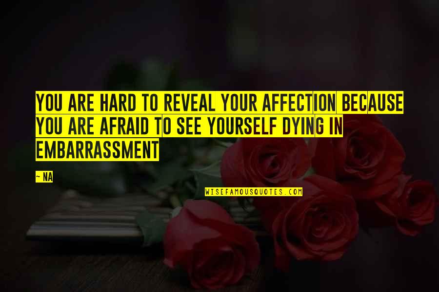 Dying To See You Quotes By Na: You are hard to reveal your affection because
