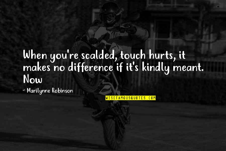 Ebonics Slang Quotes By Marilynne Robinson: When you're scalded, touch hurts, it makes no