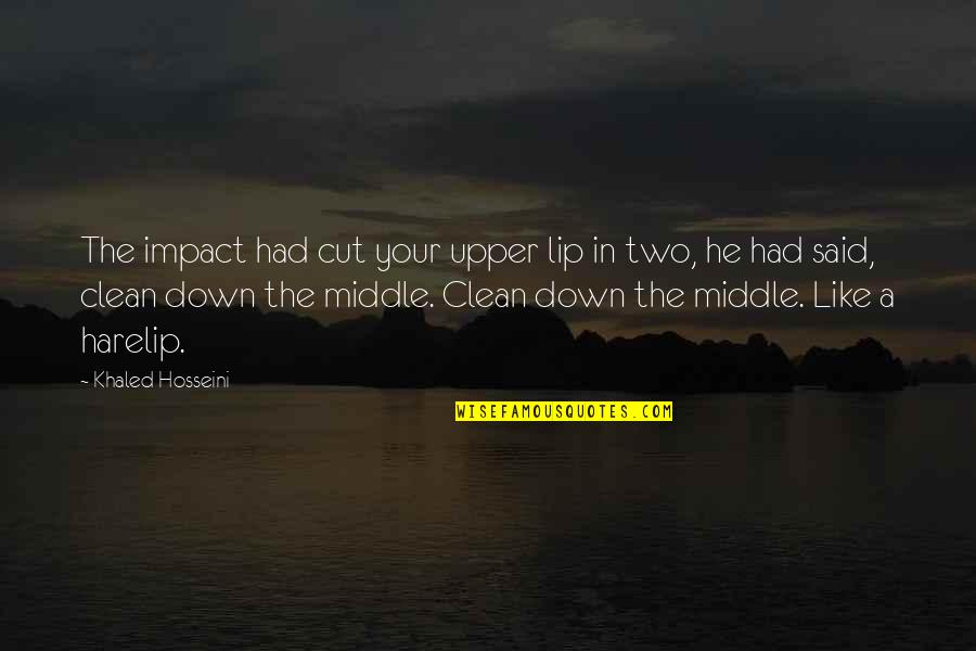 Elisif Romance Quotes By Khaled Hosseini: The impact had cut your upper lip in