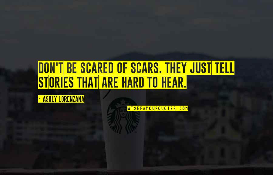 Emotional Scars Quotes By Ashly Lorenzana: Don't be scared of scars. They just tell