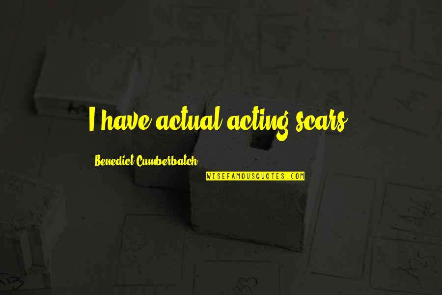 Emotionante Quotes By Benedict Cumberbatch: I have actual acting scars. Emotionante Quotes By Benedict Cumberbatch: I have actual acting scars.