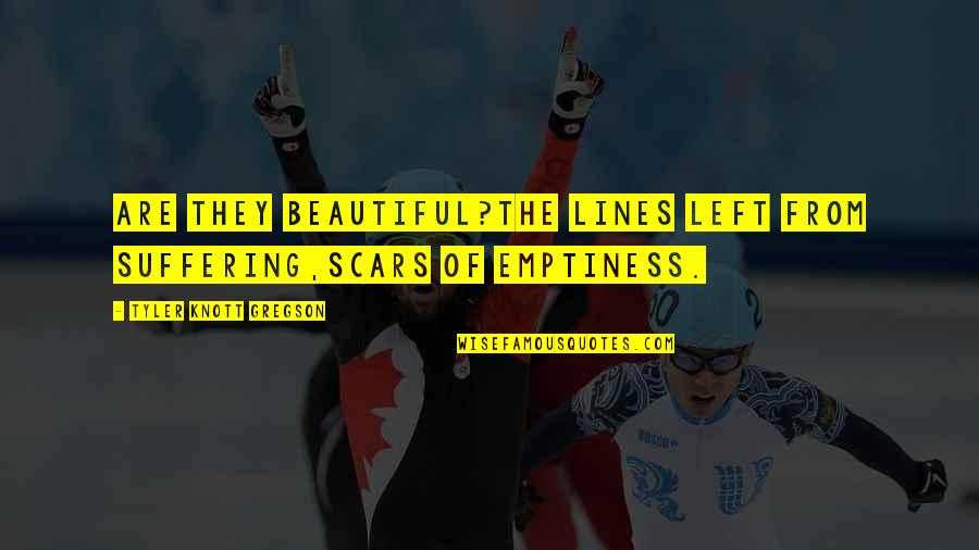 Emptinesses Quotes By Tyler Knott Gregson: Are they beautiful?The lines left from suffering,Scars of Emptinesses Quotes By Tyler Knott Gregson: Are they beautiful?The lines left from suffering,Scars of