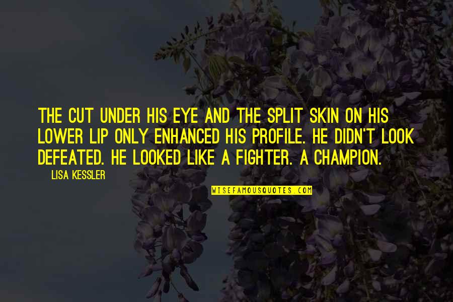 Eye On Eye Quotes By Lisa Kessler: The cut under his eye and the split