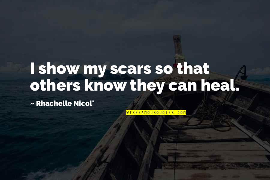 Faith For Healing Quotes By Rhachelle Nicol': I show my scars so that others know