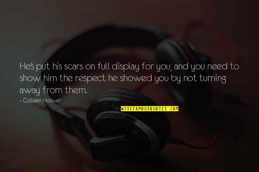 Famous Nene Quotes By Colleen Hoover: He's put his scars on full display for