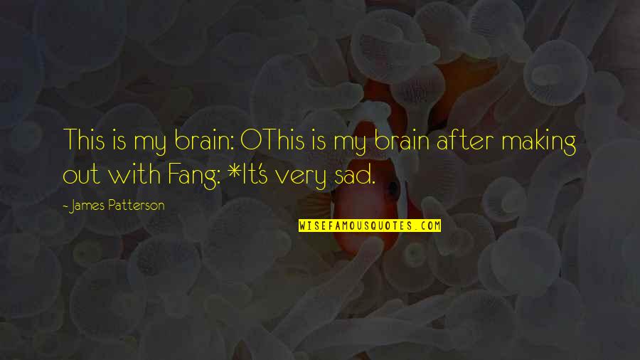 Fang Quotes By James Patterson: This is my brain: OThis is my brain