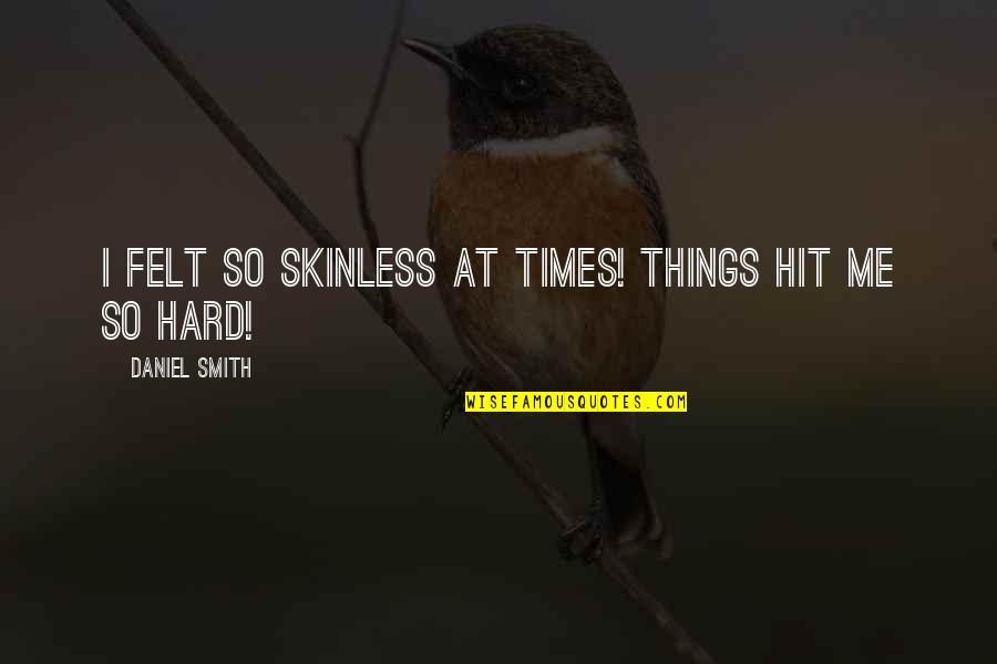 Frisian Quotes By Daniel Smith: I felt so skinless at times! Things hit