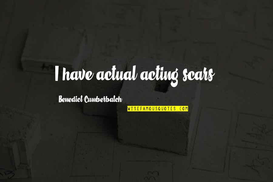 Gradishar Northwestern Quotes By Benedict Cumberbatch: I have actual acting scars. Gradishar Northwestern Quotes By Benedict Cumberbatch: I have actual acting scars.