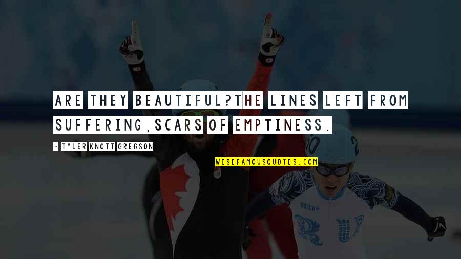 Gregson Quotes By Tyler Knott Gregson: Are they beautiful?The lines left from suffering,Scars of Gregson Quotes By Tyler Knott Gregson: Are they beautiful?The lines left from suffering,Scars of