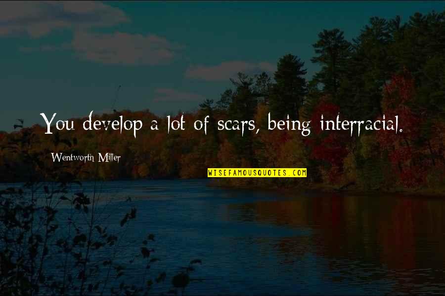 Happy 3rd Birthday Niece Quotes By Wentworth Miller: You develop a lot of scars, being interracial.