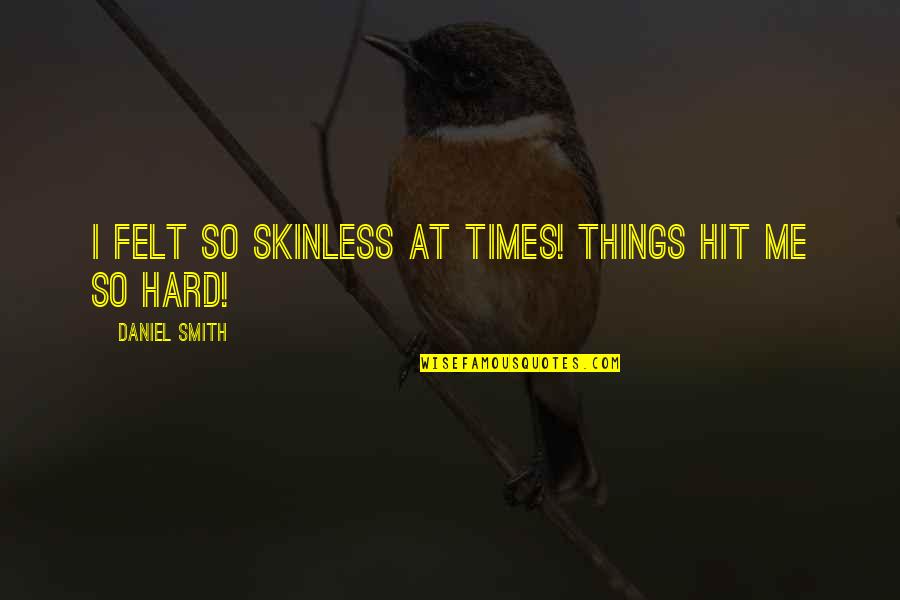 Hit Hard Quotes By Daniel Smith: I felt so skinless at times! Things hit