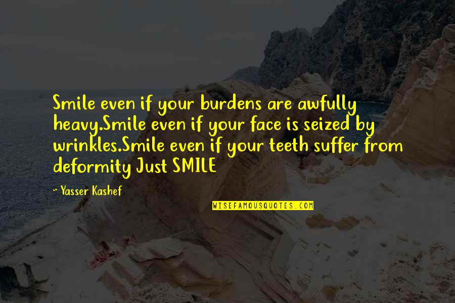 Is Heavy Quotes By Yasser Kashef: Smile even if your burdens are awfully heavy.Smile