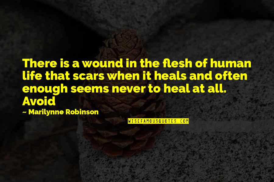 Is That All There Is To Life Quotes By Marilynne Robinson: There is a wound in the flesh of Is That All There Is To Life Quotes By Marilynne Robinson: There is a wound in the flesh of
