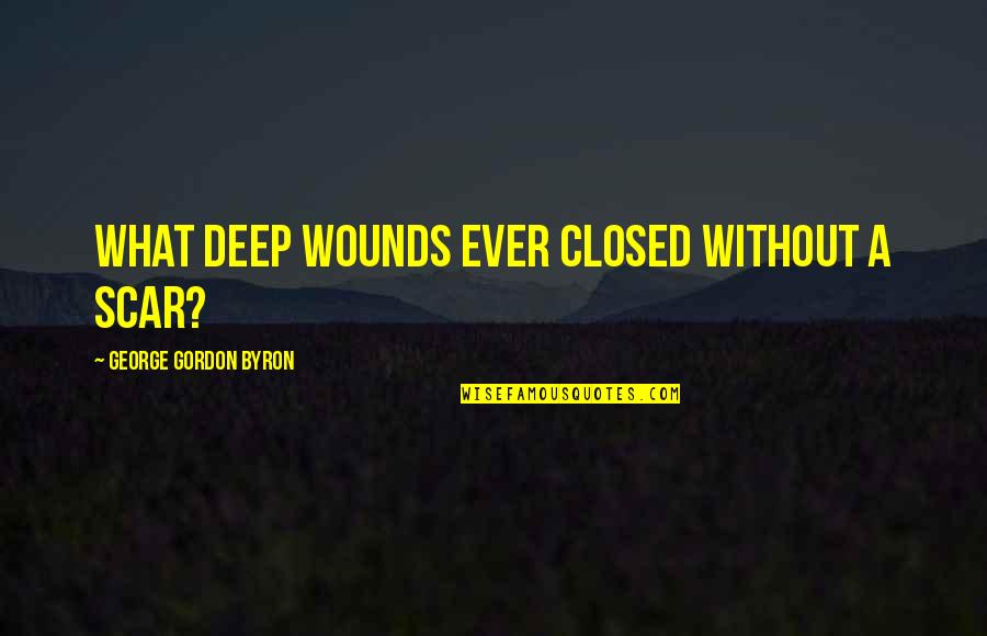 Jnudistance Quotes By George Gordon Byron: What deep wounds ever closed without a scar?