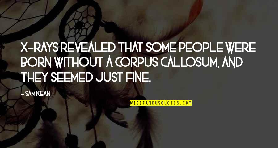 Just Fine Quotes By Sam Kean: X-rays revealed that some people were born without Just Fine Quotes By Sam Kean: X-rays revealed that some people were born without
