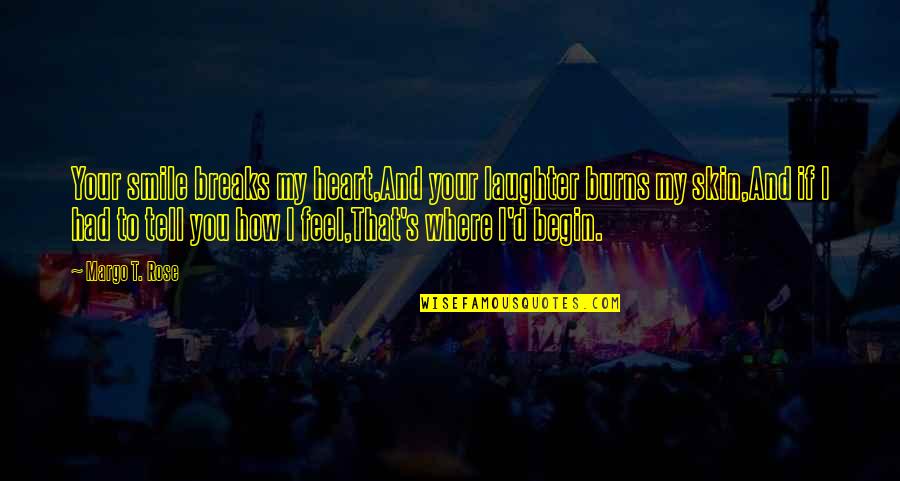 Kastelruther Spatzen Quotes By Margo T. Rose: Your smile breaks my heart,And your laughter burns