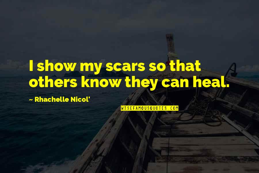 Kinane Mgh Quotes By Rhachelle Nicol': I show my scars so that others know Kinane Mgh Quotes By Rhachelle Nicol': I show my scars so that others know