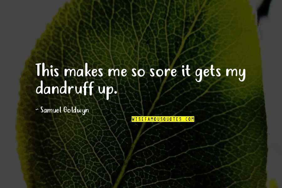 Leftover Quotes By Samuel Goldwyn: This makes me so sore it gets my