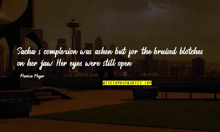 Legkippen Soorten Quotes By Marissa Meyer: Sacha's complexion was ashen but for the bruised