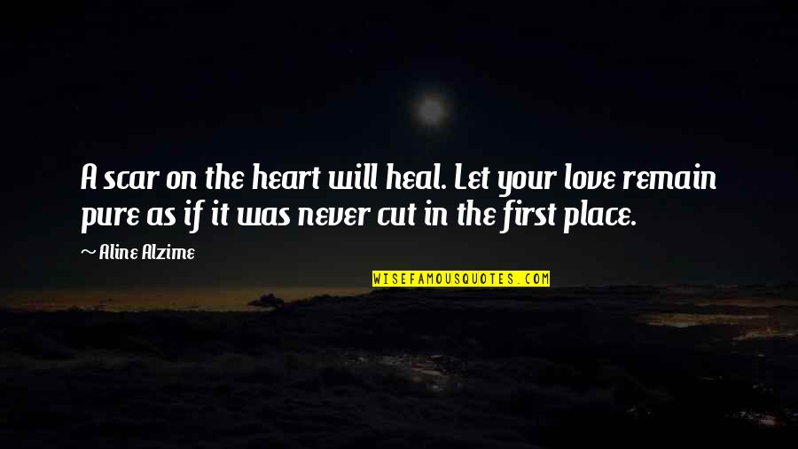 Letting Go Of Those We Love Quotes By Aline Alzime: A scar on the heart will heal. Let Letting Go Of Those We Love Quotes By Aline Alzime: A scar on the heart will heal. Let