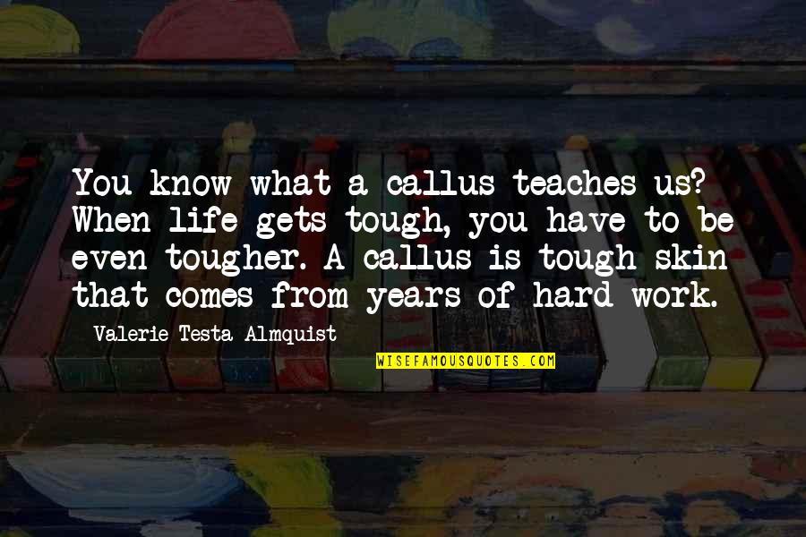 Life When It Gets Hard Quotes By Valerie Testa Almquist: You know what a callus teaches us? When