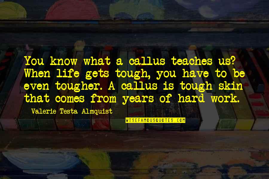 Life When It's Tough Quotes By Valerie Testa Almquist: You know what a callus teaches us? When