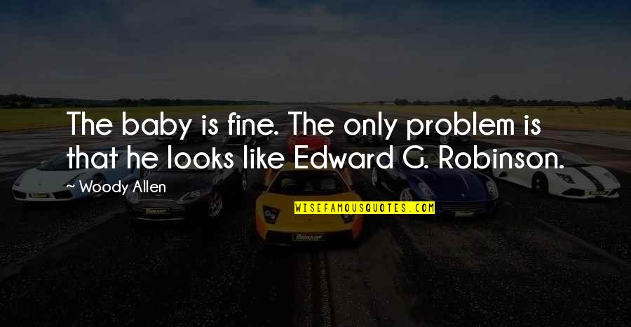 Love Staring You Right In The Face Quotes By Woody Allen: The baby is fine. The only problem is